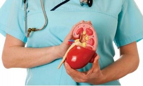 Human kidney as a habitat for the parasite Pneumococcus