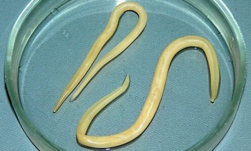 Human worm