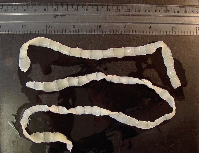 Wide tapeworm in human body