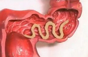 the treatment of worms