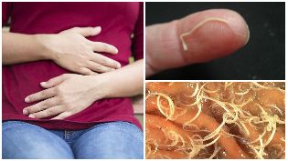 the worms in the human body